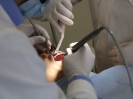 Dentistas querem que governo regularize carreira no sns