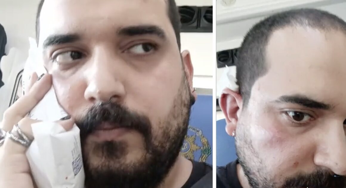 Be de caminha preocupado com ataques "fascistas" culpa "notícias falsas" e "desinformação"