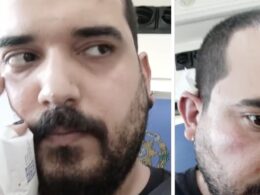 Antifascista queixa-se de ter sido agredido por "neonazi" em guimarães