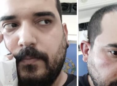 Antifascista queixa-se de ter sido agredido por "neonazi" em guimarães