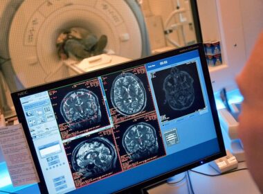 Mulheres com cancros diagnosticados em 2018 sobreviveram mais do que homens