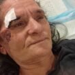 Vila verde: mulher vai fazer queixa a acampamento e acaba espancada com um pau