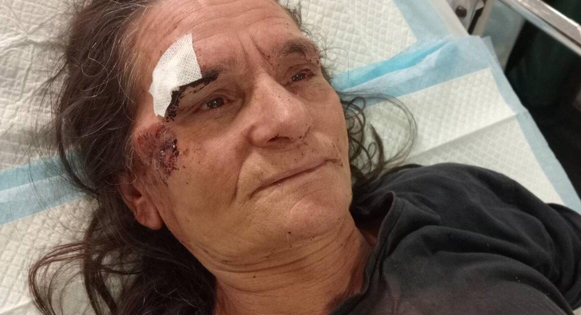 Vila verde: mulher vai fazer queixa a acampamento e acaba espancada com um pau