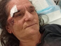 Vila verde: mulher vai fazer queixa a acampamento e acaba espancada com um pau
