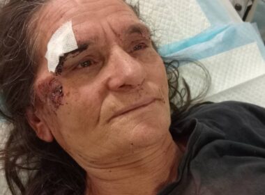 Vila verde: mulher vai fazer queixa a acampamento e acaba espancada com um pau