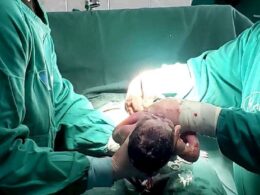 Trás-os-montes: mulher entra nas urgências com dor nas costas e sai com um bebé